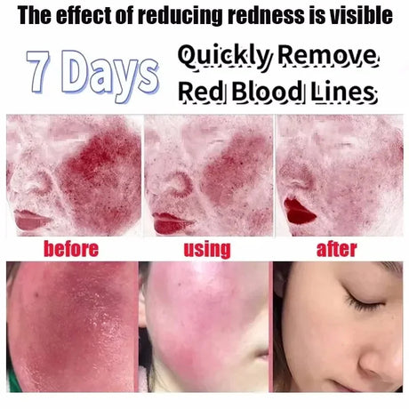 B5 Repair Cream Moisturizing Hydrating Effectively Solves Dry Chapped And Red Skin Nourishes Improve Repair Sunscreen Cream