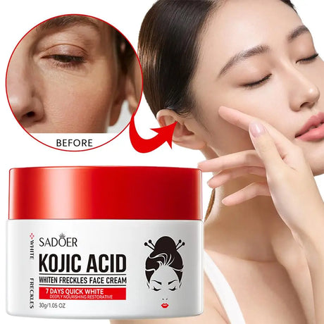 SADDER Kojic Acid Face Cream for Dark Spots Freckles Skin Care with Vitamin C, Whitening Treatment, Overnight Repair Moisturizer