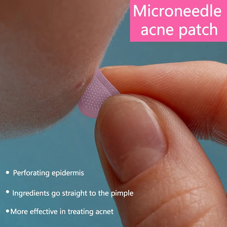 Water Soluble Salicylic Acid Removal Acne Stickers Microneedles Blemish Face Treatment Healing Skin Patches Care Tools