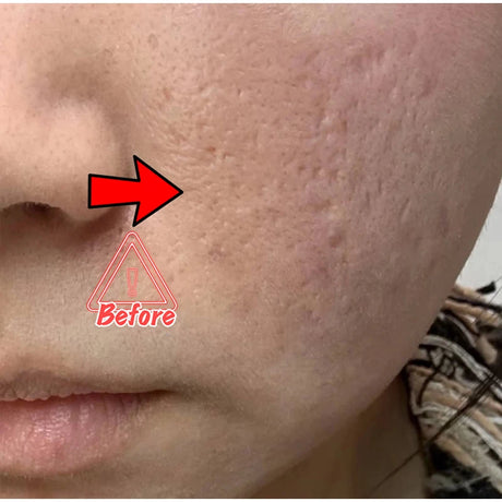 Dark Spot Correcting Glow Serum,Dullness,Acne,And Melanin Remover,Niacinamide Facial Skin Moisturizing Brightening Skincare