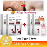 Remove Large Pores Serum Salicylic Acid Facial Pore Shrinking Tightening Pore Minimizing Firming Smooth Essence Korean Skin Care