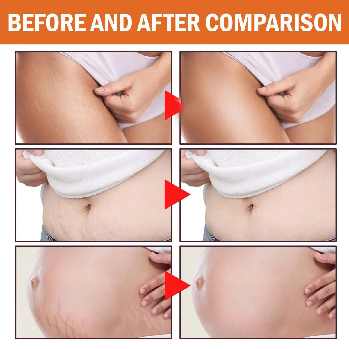 TRSTAY Stretch Mark Scar Repair Cream Enhances Skin Elasticity Moisture Collagen Improvement Safe And Effective