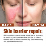 Instant Facial Redness Repair Cream Soothing Red Blood Rosacea Treatment Improve Sensitive Skin Anti Redness Skin Care Cosmetics