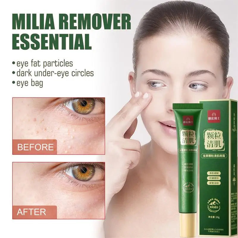 Fat Granules Remover Eye Cream Anti-Puffiness Anti Inflammatory Reduce Dark Circles Eyebags Fade Lines Moisturizing Eye Care