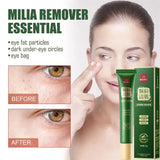 Fat Granules Remover Eye Cream Anti-Puffiness Anti Inflammatory Reduce Dark Circles Eyebags Fade Lines Moisturizing Eye Care