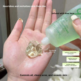 Aloe Vera Gel Moisturizing Face Body Cream Sunburn Repair Hydrating Soothing After Sun Acne Treatment Sensitive Skin Care