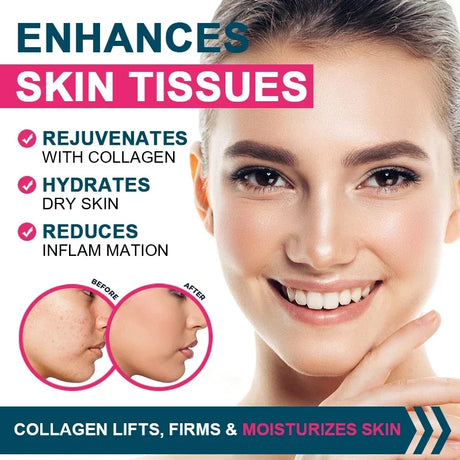 Multiple Collagen Complex - Types I, II, III, V, and X - Hair, Skin, Nail, Bones, Joint Health Support