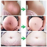 Snail Removes Stretch Mark Cream To Remove Postpartum Obesity Pregnant Women Repair Anti-Aging Anti-Winkles Firming Body Cream