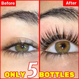 Fast Eyelash Growth Serum Natural Eyelashes Enhancer Longer Thicker Eyebrows Lift Essence Fuller Lashes Eye Care Korean Cosmetic