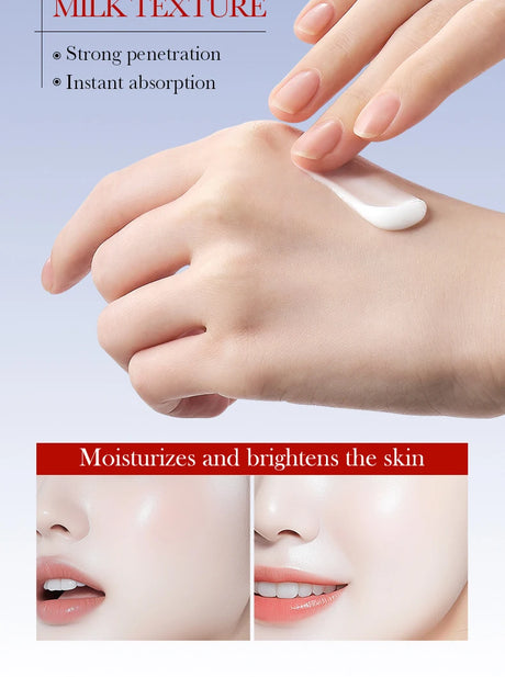 SADOER Anti Freckle Cream Face Brightening Creams Spot Removing Anti-aging Moisturizing Freckles Removal Facial Cream Skin Care