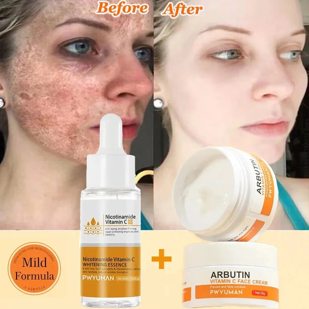 Dark Spots Remover Whitening Face Set Freckle Melanin Correcting Reduce Fine Lines Brighten Essence Korean Beauty Skin Care ﻿