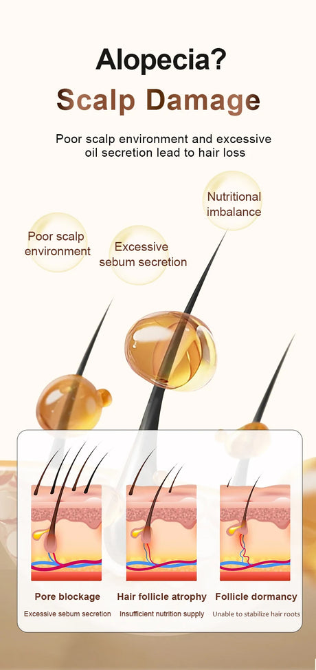 Zhang Guang 101 Ginseng Nourishing Liquid TCM Formula 120ml Anti Hair Loss Hair Growth Regrowth Tonic Alopecia Areata Buster