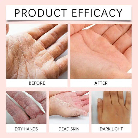 Retinol Hand Cream Firming Hand Lotion Retinol Moisturizer For Aging Dry Cracked Hands Hydrates & Soothes Dry Hands Non-Greasy