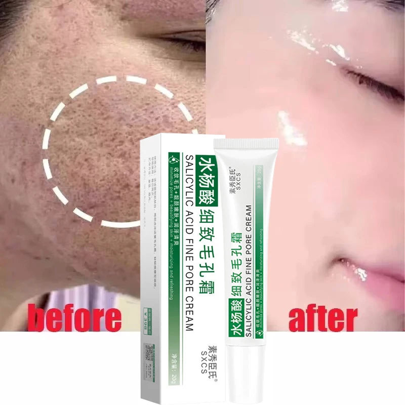 Salicylic Acid Pore Shrinking Cream Quick Elimination Large Pores Remove Blackehead Tighten Face Smooth Skin Korean Care Product