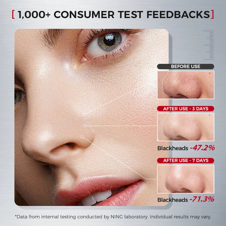 NING DERMOLOGIE Amino Acid Korean Facial Cleanser with Salicylic Acid Help with Pore Tighten, Acne & Blackheads