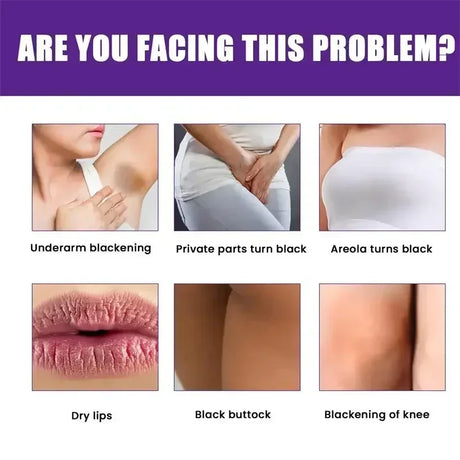 Skin Whitening Serum Private Parts Underarm Bleaching Serum Whiten Butt Knee Brighten Inner Thigh Arm Body Remove Dark Melanin