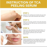 High Quality 50% Chemical Peel Acid Skin Superforce Pigmentation Lightening Melanin Acne Treatment Remove Scar
