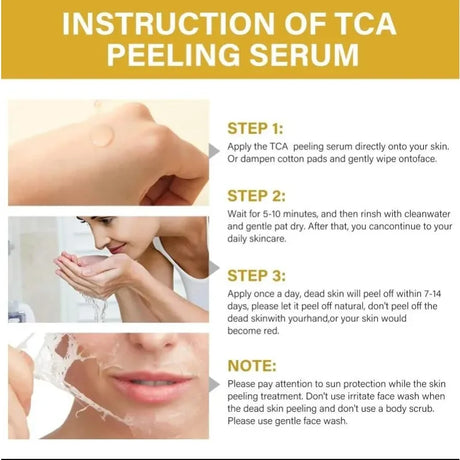High Quality 50% Chemical Peel Acid Skin Superforce Pigmentation Lightening Melanin Acne Treatment Remove Scar