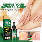 7 Days Nail Fungus Treatment Serum Ginger Anti-infective Paronychia Onychomycosis Toe Foot Nail Fungal Repair Gel Hand Foot Care
