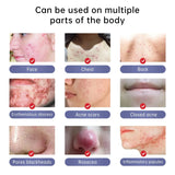 Herbal Acne Removal Face Cream Clears Pimple Scar Black Dots Gel Acne Treatment Shrink Pore Skin Whitening Lightening Ointment