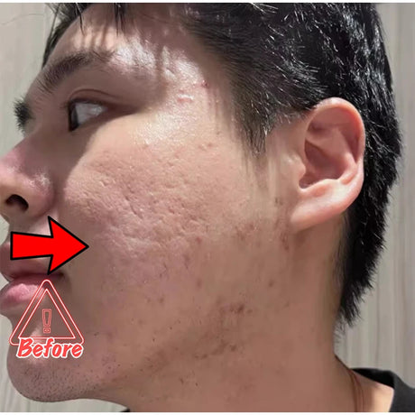 Dark Spot Correcting Glow Serum,Dullness,Acne,And Melanin Remover,Niacinamide Facial Skin Moisturizing Brightening Skincare