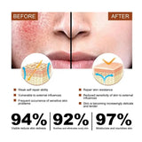 Facial Redness Repair Cream Improve Sensitive Skin Dryness Hydrating Sooth Lotion Removal Rosacea Day Night Korean Cosmetics