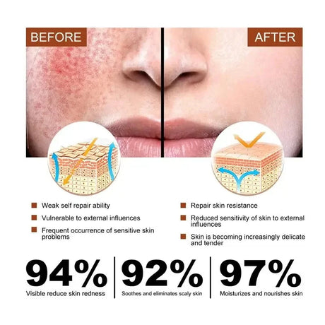 Facial Redness Repair Cream Improve Sensitive Skin Dryness Hydrating Sooth Lotion Removal Rosacea Day Night Korean Cosmetics