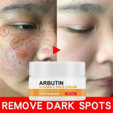 Dark Spots Remover Whitening Face Set Freckle Melanin Correcting Reduce Fine Lines Brighten Essence Korean Beauty Skin Care ﻿