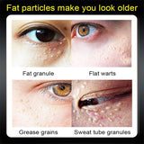 Fat Granules Remover Eye Cream Anti-Puffiness Anti Inflammatory Reduce Dark Circles Eyebags Fade Lines Moisturizing Eye Care