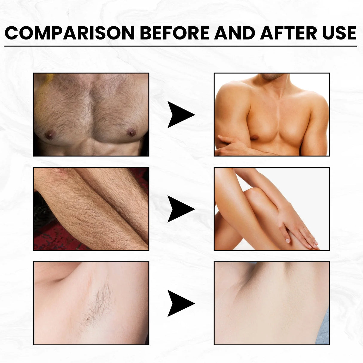 Hair Removal Cream Gentle Epilator Cream Intimate Areas Health Painless Hair Remover Growth Inhibitor For Woman Men Body Care