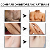 Hair Removal Cream Gentle Epilator Cream Intimate Areas Health Painless Hair Remover Growth Inhibitor For Woman Men Body Care