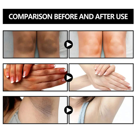 Body Whitening Soap Deep Skin Bleaching Brighten Body Scrub Knees Intimate Parts Armpits White Nourishing Care Soap
