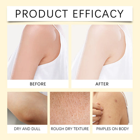 Bee Venom Skin Moisturizer Nourish Dryness Skin Anti Cellulite Firming Brightening Smoothing Body & Face Care Creams Non-Greasy