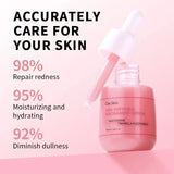 Niacinamide Dark Spot Remove Serum Face Freckle Melanin Correcting Moisturizing Brightening Anti Pigmentation Repair Skin Care