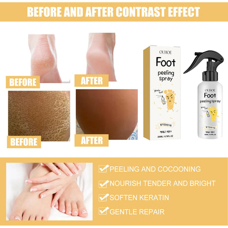 Ouhoe Foot Exfoliating Spray 72H Moisture Lock Callus Softener Anti Dry Crack Repair Odor Control Brightening Foot Care Liquid