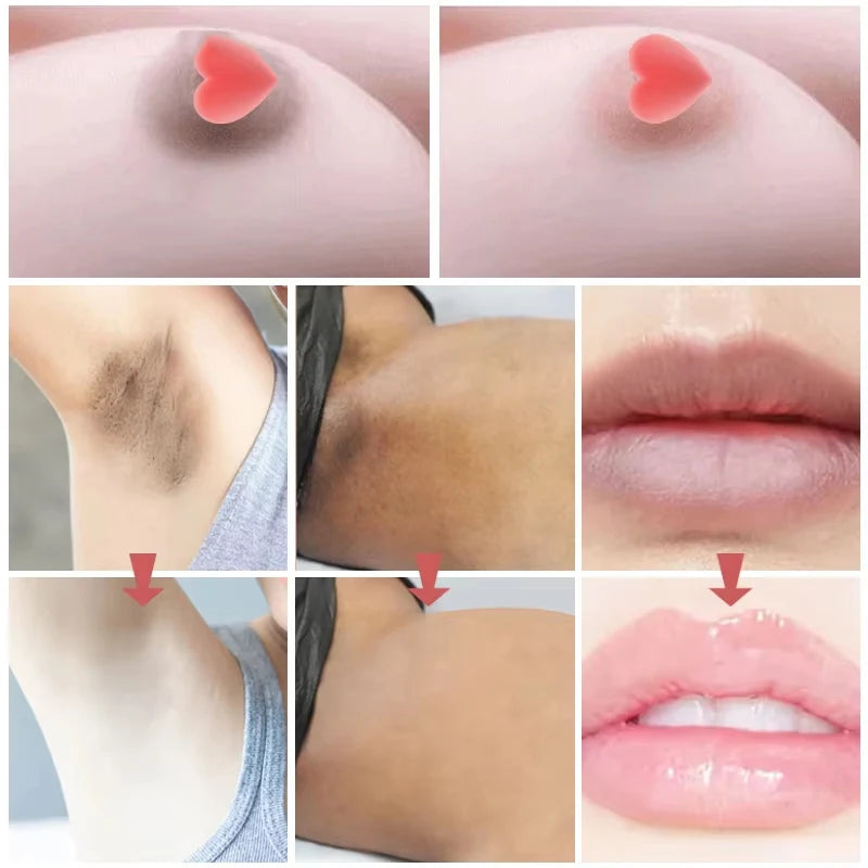 Body Whitening Cream Private Parts Bleach Arm Knees Lip Dark Skin Brighten Melanin Intimate Area Pink Essence Moisturizing Care