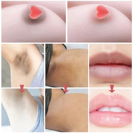 Body Whitening Cream Private Parts Bleach Arm Knees Lip Dark Skin Brighten Melanin Intimate Area Pink Essence Moisturizing Care