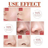 Pore Shrink Face Serum Remove Blackheads Acne Acidity Oil Control Repair Essence Moisturizing Nourish Pores Firming Facial Care