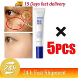 Powerful Spot-Removing Whiten Cream Brighten Skin Fast Eliminates Melanin Pigmentation Melasma Dark Spots Korean Face Skin Care
