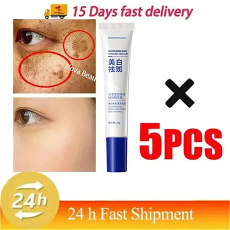Powerful Spot-Removing Whiten Cream Brighten Skin Fast Eliminates Melanin Pigmentation Melasma Dark Spots Korean Face Skin Care