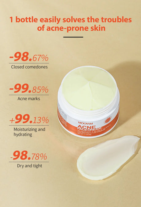 Herbal Acne Treatment Cream Anti Acne Face Cream Pimple Removal Spots Oil Control Shrink Pores Moisturizing Skin Care Cream
