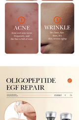 BIOAOUA Oligopeptide Face Skin Repair Freeze-dried Powder Set Sensitive Skin Moisturizing and Smoothing Hyaluronic Acid Essence