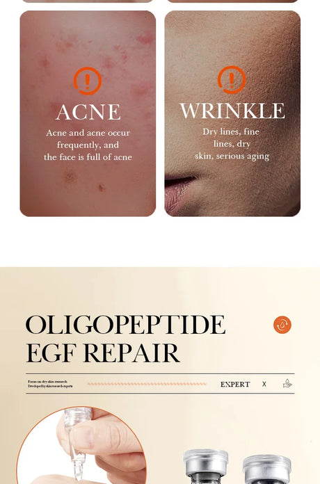 BIOAOUA Oligopeptide Face Skin Repair Freeze-dried Powder Set Sensitive Skin Moisturizing and Smoothing Hyaluronic Acid Essence
