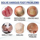Foot Soaking Salts Pedicure Foot Softening Soak Pedicure Foot Soak Foots 10pcs Organic Foot Softening Capsule Shape Up Care