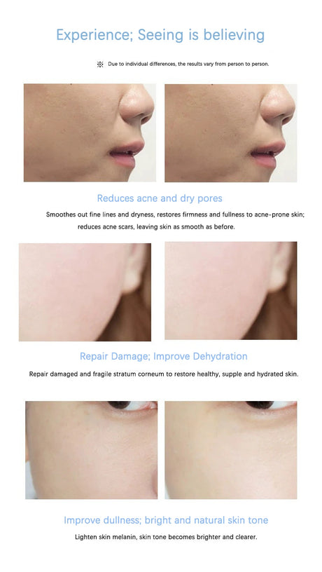 Oligopeptide Placenta Freeze-dried Powder Essence Repair Facial Moisturiz Hydrating Pore Shrinkage Skin Rejuvenation Skin Care
