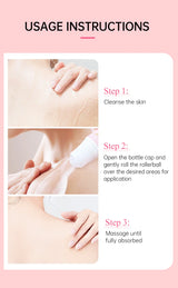 Chicken Skin Removal Cream Body Curing Keratosis Follicle Pore Spot Dull Treatment Whitening Moisturizing Body Care JoyPretty