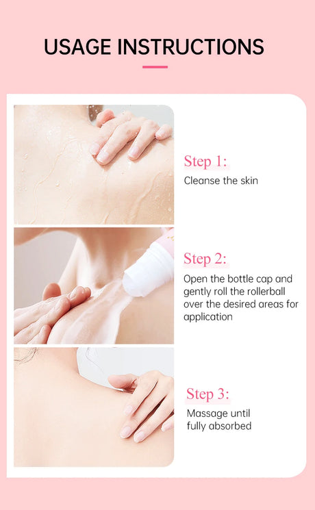 Chicken Skin Removal Cream Body Curing Keratosis Follicle Pore Spot Dull Treatment Whitening Moisturizing Body Care JoyPretty