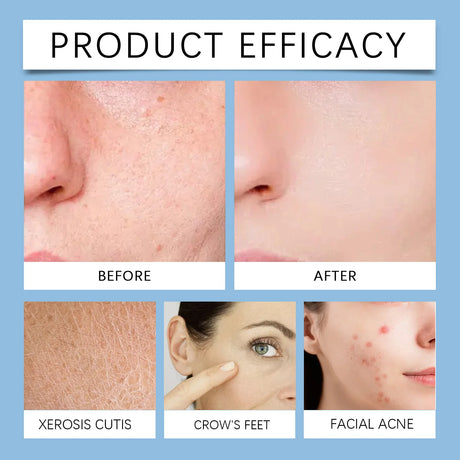 Salicylic Acid Acne-Clearing Toner Pads,Dual Action Exfoliation,Deep Clear Acne&Refine Pores,Centella+Allantoin,Soothing&Anti Redness,Polish Strawberry Nose&Rough Texture,Hydrating&Non-tightening,Convenient Dual Textured Pads