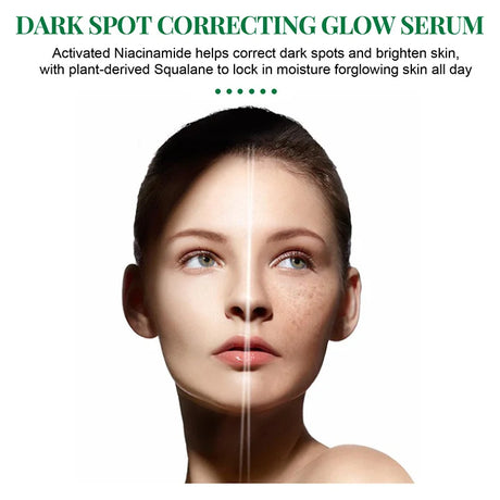 Dark Spot Correcting Glow Serum,Dullness,Acne,And Melanin Remover,Niacinamide Facial Skin Moisturizing Brightening Skincare