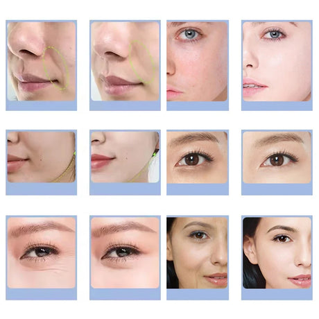 7 Types Oxygen Jet Spa Capsule Serum Gel Facial CO2 Oxygen Bubble Machine Facial Massage Exfoliate Rejuvenation Beauty Device